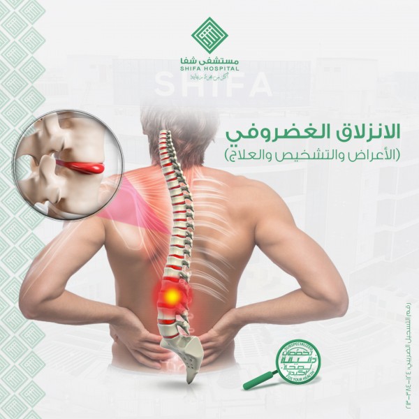 الانزلاق الغضروفي