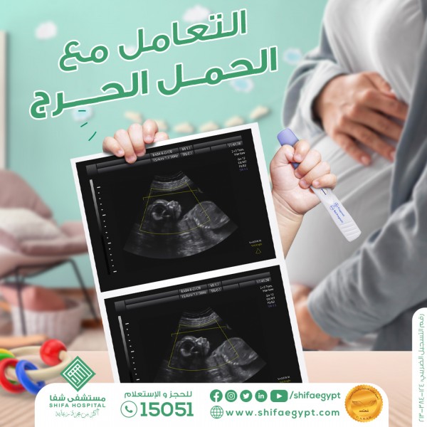 التعامل مع الحمل الحرج
